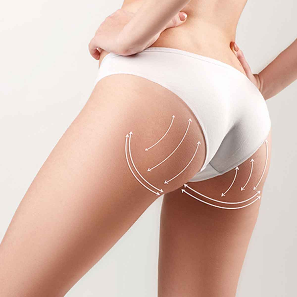 plastic surgeryy in colombia buttocks gluteoplasty